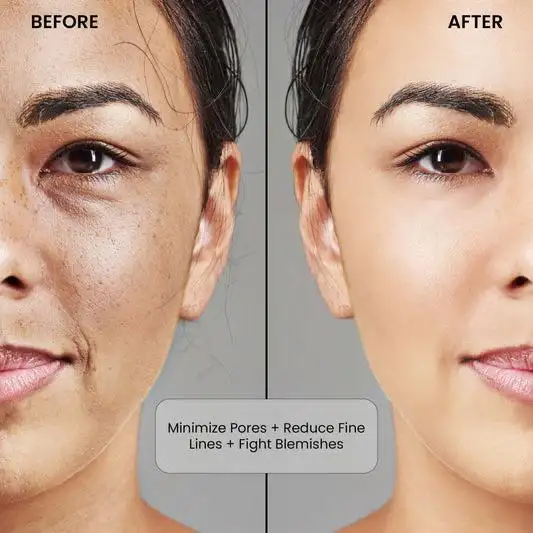 Kit For Dry Skin 
