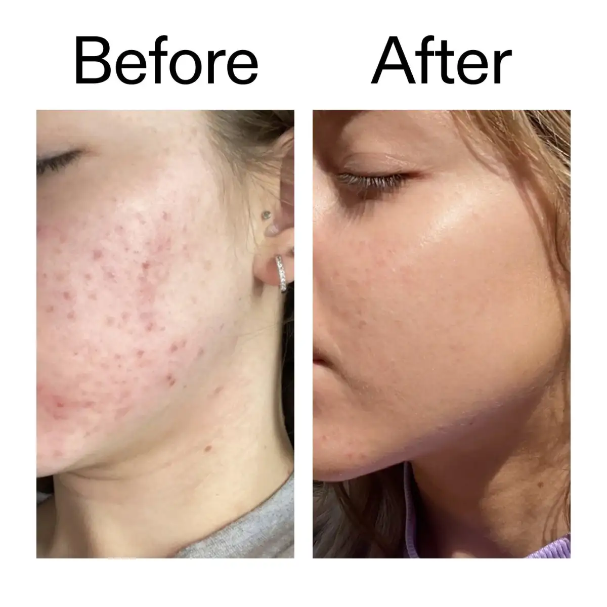 10% Niacinamide Serum – Oil Control