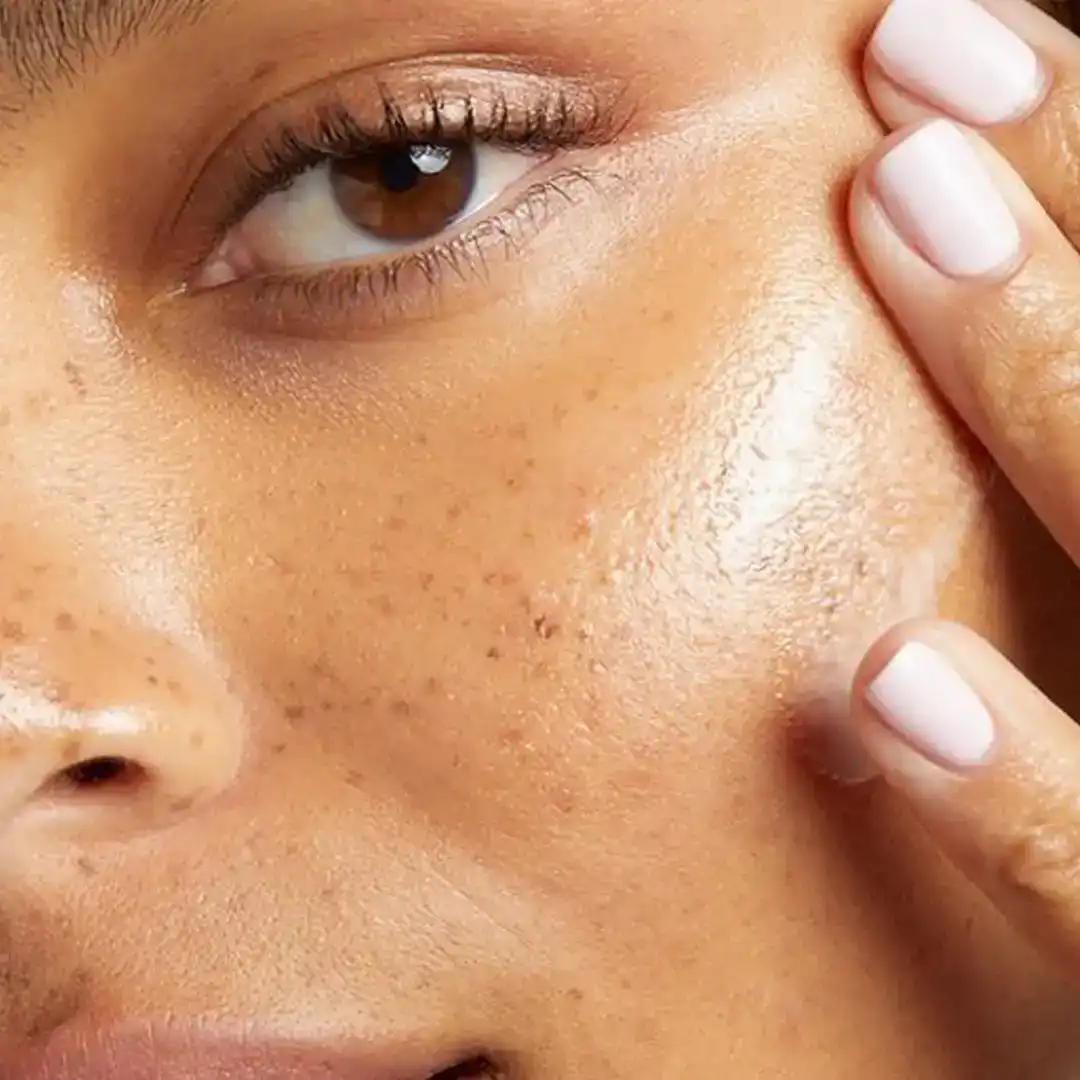 DARK SPOTS